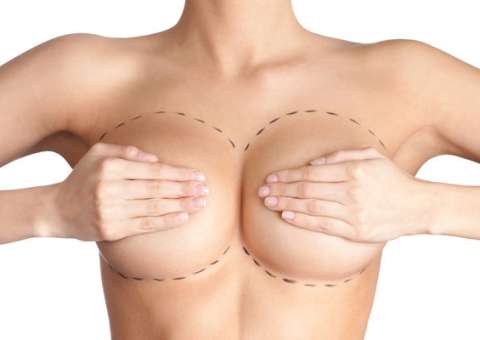nang-nguc-bang-tui-xop-breast-implants
